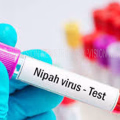 #nipah| ഉള്ള്യേരിയില്‍ നിപാ ജാഗ്രതാ  സമിതി യോഗം ചേര്‍ന്നു