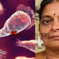 അമീബിക് മസ്തിഷ്ക ജ്വരം; ചികിത്സയിലായിരുന്ന മലപ്പുറം സ്വദേശിനി മരിച്ചു