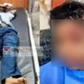 കണ്ണൂരിൽ വീണ്ടും ഭീതി പരത്തി തെരുവുനായ അക്രമം ; വിദ്യാർഥികൾ ഉൾപ്പെടെ നാലുപേർക്ക് കടിയേറ്റു