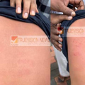 പാനൂരിനടുത്ത് പൊയിലൂരിൽ പത്താം ക്ലാസ് വിദ്യാർത്ഥിനികളുടെ കൂടെ യാത്ര ചെയ്തതിന് അതേ സ്കൂളിലെ പത്താം ക്ലാസ് വിദ്യാർത്ഥികൾക്ക് മർദ്ദനം ; പരിക്ക്