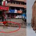 എന്ത് വിധിയിത് .....: പനിക്ക് ചികിത്സ തേടിയെത്തിയ വീട്ടമ്മ ബസ്സ്റ്റാൻഡിലെ കുഴിയിൽ അകപ്പെട്ടു; കാലിന് പരിക്കുമായി ആശുപത്രിയിൽ