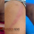 ബ്രാഞ്ച് സെക്രട്ടറി ഉൾപ്പെടെ ആറു പേർക്ക് മർദ്ദനം; പള്ളിപ്പെരുന്നാൾ സ്ഥലത്ത് സംസാരിച്ചിരുന്ന യുവാക്കളെ പൊലീസ് തല്ലിച്ചതച്ചതായി ആരോപണം