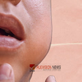 മുണ്ടിനീര് രോഗം സ്ഥിരീകരിച്ചു ;ആലപ്പുഴയിലെ സ്കൂളില് 21 ദിവസം അവധി പ്രഖ്യാപിച്ച് കളക്ടർ