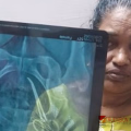 വണ്ടാനം മെഡിക്കൽ കോളേജിൽ ചികിത്സാ പിഴവ്; വയറ്റിൽ കത്രിക കണ്ടെത്തിയ സംഭവത്തിൽ മന്ത്രി റിപ്പോർട്ട് തേടി