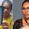 ആലപ്പുഴ ശസ്ത്രക്രിയ വീഴ്ച: ഉഷാ ജോസഫിന്റെ ശസ്ത്രക്രിയ നാളെ നടക്കും; ചികിത്സാ ചെലവ് സർക്കാർ വഹിക്കും - കെ കെ ശൈലജ