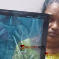വണ്ടാനം മെഡിക്കൽ കോളജിൽ രോഗിയുടെ വയറ്റിൽ കത്രിക കുടുങ്ങിയ സംഭവം; ഡോ. ജെ ഷാഹിദയെ പ്രതിചേർക്കും