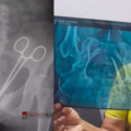 'ഞങ്ങൾ കത്രിക വിഴുങ്ങിയതാണോ?': വണ്ടാനത്തെ മെഡിക്കൽ റിപ്പോർട്ടിനെതിരെ ഉഷയുടെ കുടുംബം; നീതിക്കായി പോരാട്ടം തുടരുമെന്ന് മകൻ