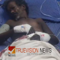 തേങ്ങ പറിക്കുന്നതിനിടെ കടന്നൽ ആക്രമണം; തൊഴിലാളികൾക്കും സഹായികളായ സ്ത്രീകൾക്കും കുത്തേറ്റു