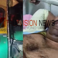 നാദാപുരത്ത് വളർത്ത് പോത്തിന്റെ ആക്രമണം; ഓട്ടോഡ്രൈവറായ വളയം സ്വദേശിക്ക് പരിക്ക് 