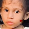 കോഴിക്കോട് ഡൈനിങ് ടേബിളില്‍ നിന്നും വീണ് പരിക്കേറ്റ മൂന്നുവയസുകാരി മരിച്ചു