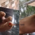 കോഴിക്കോട് വീണ്ടും ചികിത്സ പിഴവ് പരാതി; ഞരമ്പ് മുറിഞ്ഞത് അറിഞ്ഞില്ല, കാൽവിരൽ മുറിച്ചുമാറ്റേണ്ടി വന്നു; കല്ലാച്ചി വിംസ് ആശുപത്രിയിലെ ഡോക്ടർക്കെതിരെ കേസ്
