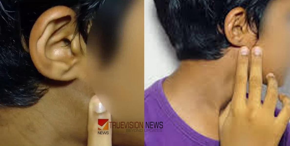 'കുറ്റം സമ്മതിച്ചെന്ന് പിടിഎ', വിദ്യാർഥിയുടെ കർണപുടം തകർത്ത സംഭവം; ലക്ഷ്യം തെറ്റി, മനഃപൂർവ ചെയ്തതല്ലെന്ന് ഹെഡ്മാസ്റ്റർ