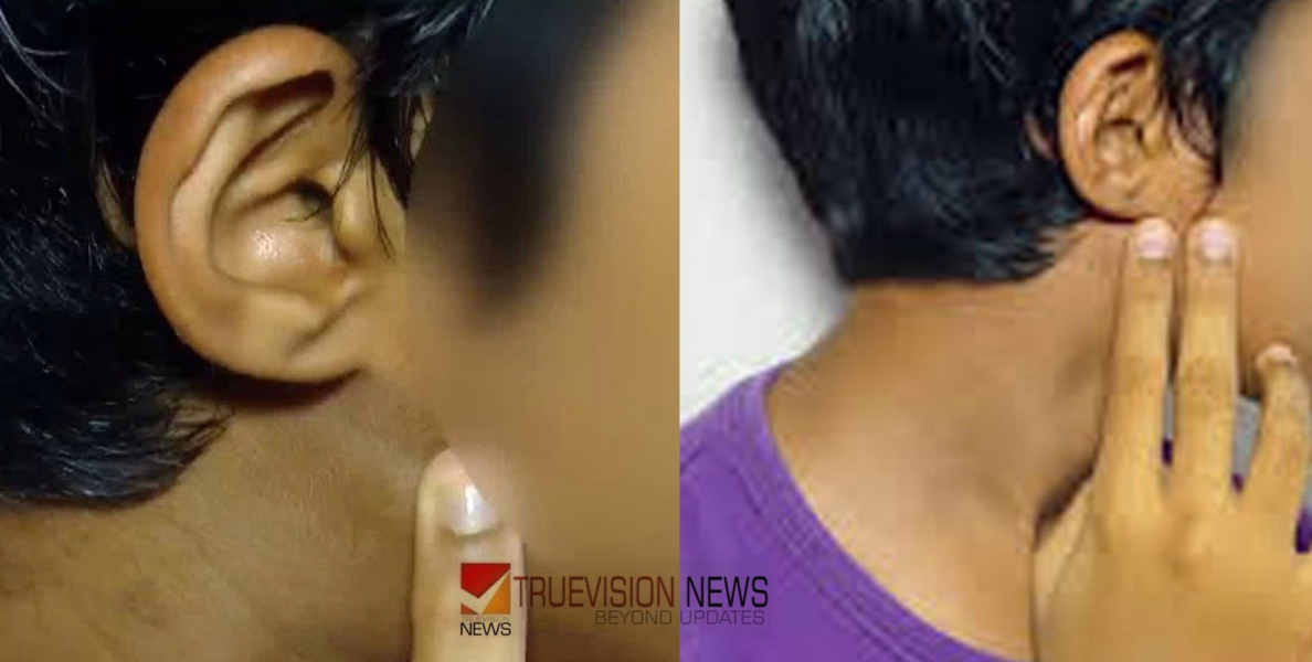ഹെഡ്‌മാസ്റ്റർ വിദ്യാർത്ഥിയുടെ കർണ്ണപടം തകർത്ത സംഭവം; പൊതു വിദ്യാഭ്യാസ ഡയറക്ടർക്ക് റിപ്പോർട്ട് സമർപ്പിച്ചു, നടപടിയുണ്ടാകുമെന്ന് സൂചന