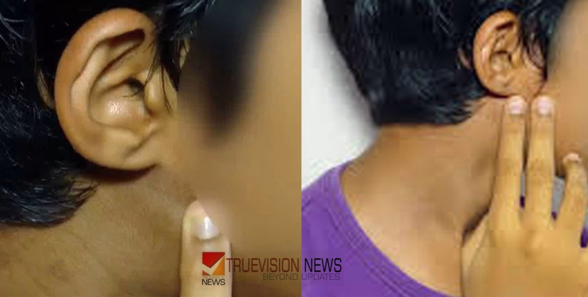വിദ്യാര്‍ത്ഥിയുടെ മുഖത്തടിച്ച് കർണ്ണപടം പൊട്ടിച്ച സംഭവം; ഹെഡ്മാസ്റ്റര്‍ക്കെതിരെ ജാമ്യമില്ല വകുപ്പ് പ്രകാരം  കേസെടുത്ത് പൊലീസ്
