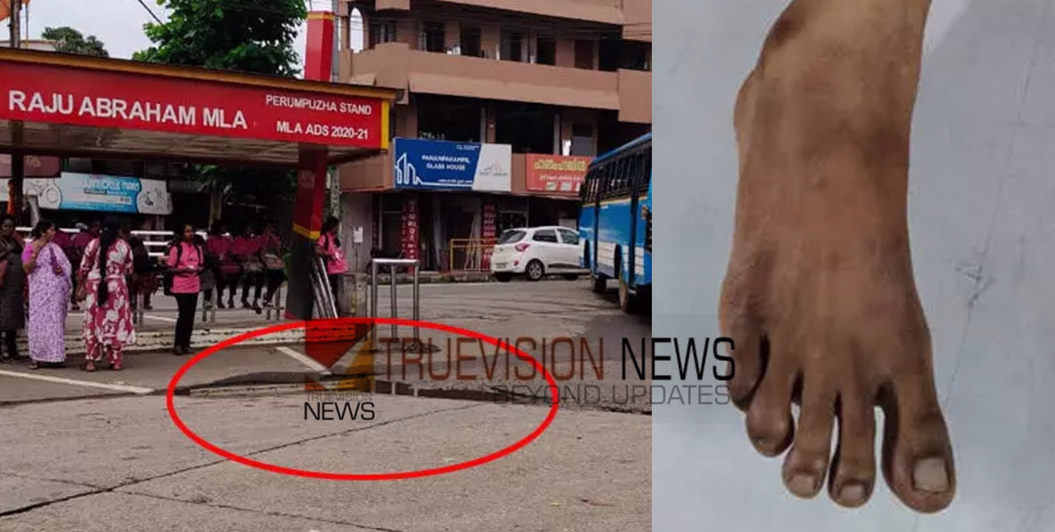 എന്ത് വിധിയിത് .....: പനിക്ക് ചികിത്സ തേടിയെത്തിയ വീട്ടമ്മ ബസ്‍സ്റ്റാൻഡി​ലെ കുഴിയിൽ അകപ്പെട്ടു; കാലിന് പരിക്കുമായി ആശുപത്രിയിൽ