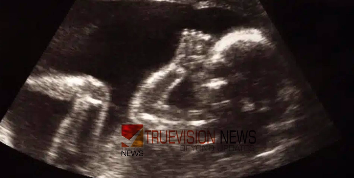 പെൺകുഞ്ഞാണെങ്കിൽ ഗർഭച്ഛിദ്രം,  ഒരു പരിശോധനയ്ക്ക് 15,000 രൂപ വരെ; പൂനെയിൽ മൊബൈൽ ആപ്പ് വഴി ലിംഗനിർണ്ണയം നടത്തിയ സംഘം അറസ്റ്റിൽ