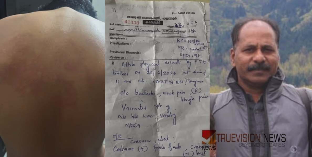 കായികാധ്യാപകൻ്റെ ക്രൂരത; പയ്യന്നൂരിൽ എട്ടാം ക്ലാസ് വിദ്യാർത്ഥിക്ക് നേരെ ക്രൂരമർദ്ദനം; പൊലീസ് കേസെടുത്തു