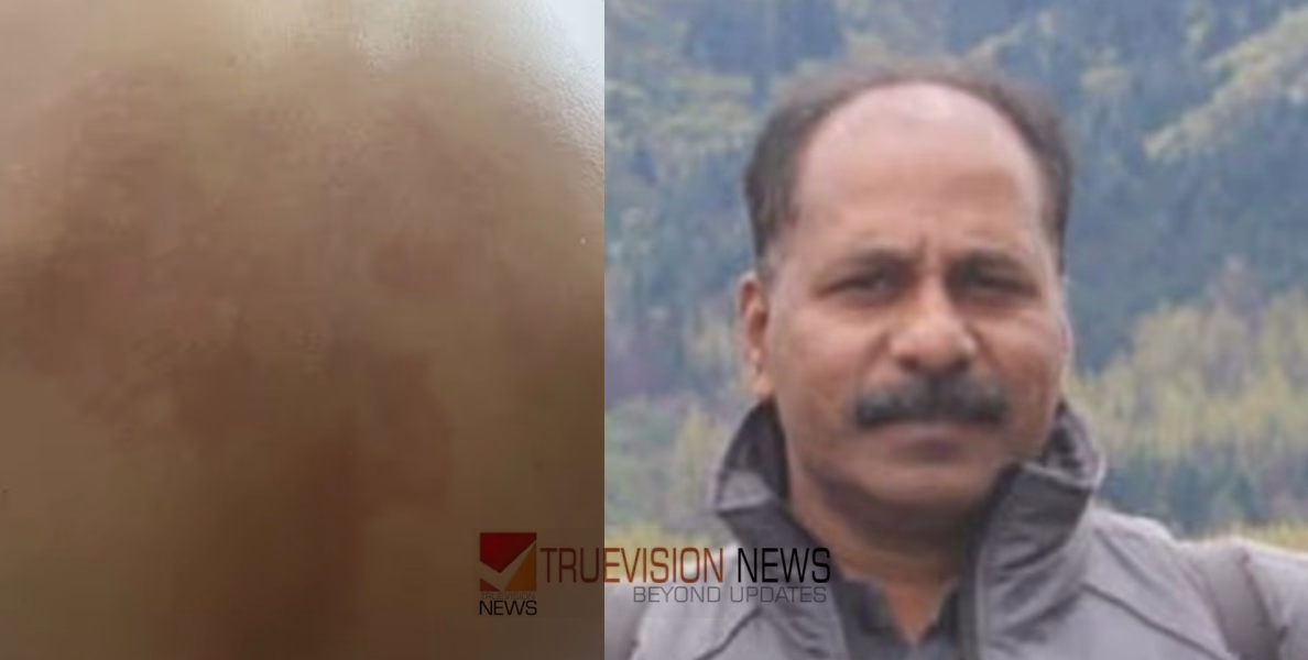 'തൊണ്ടയ്ക്ക് കുത്തിപ്പിടിച്ച് ശ്വാസം മുട്ടിക്കാൻ നോക്കി'; പയ്യന്നൂരിൽ എട്ടാം ക്ലാസ് വിദ്യാർത്ഥിക്ക് മർദ്ദനമേറ്റ സംഭവം; കായികാധ്യാപകൻ്റെ ക്രൂരത വിവരിച്ച് അമ്മ